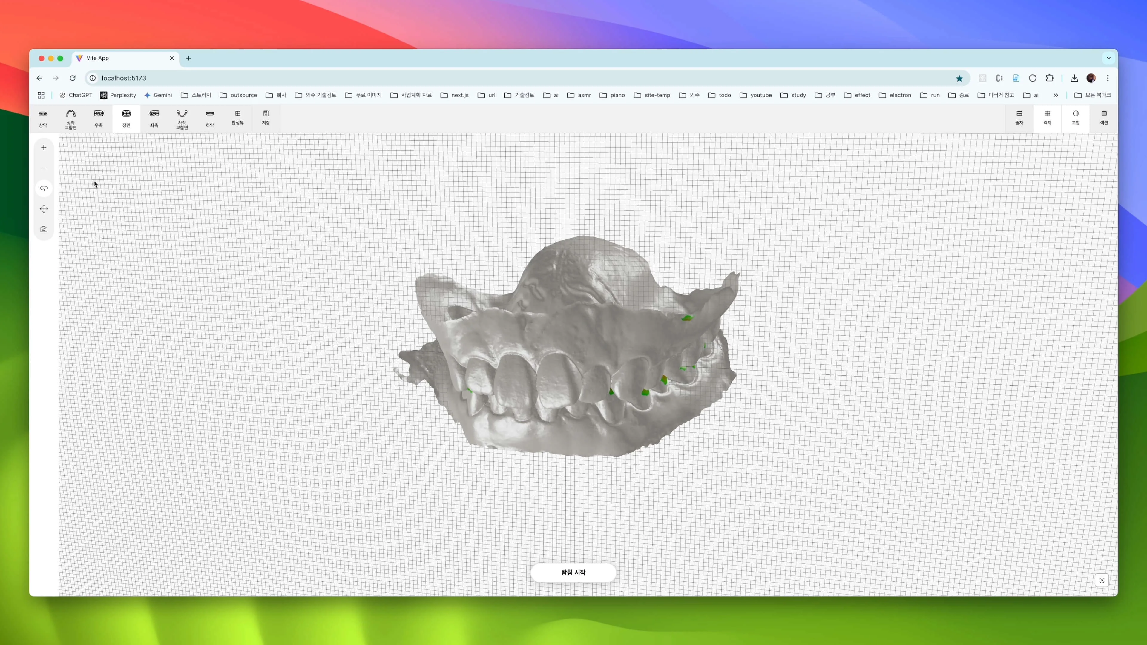 Webceph - 치아교정 및 양악수술을 위한 3D 치아 분석 툴 개발